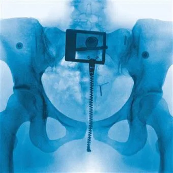 Lorde-Virgin Vinüülplaadid