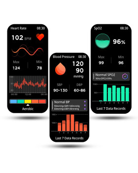 Manta Revo SWU401RGD Rose Gold-foto8